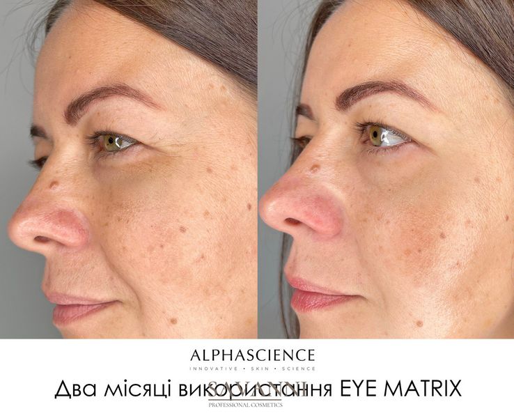 Комплексний рекструктуризант для очей Alphascience EYE MATRIX 15ML Alph10015 фото 2 savanni.com.ua