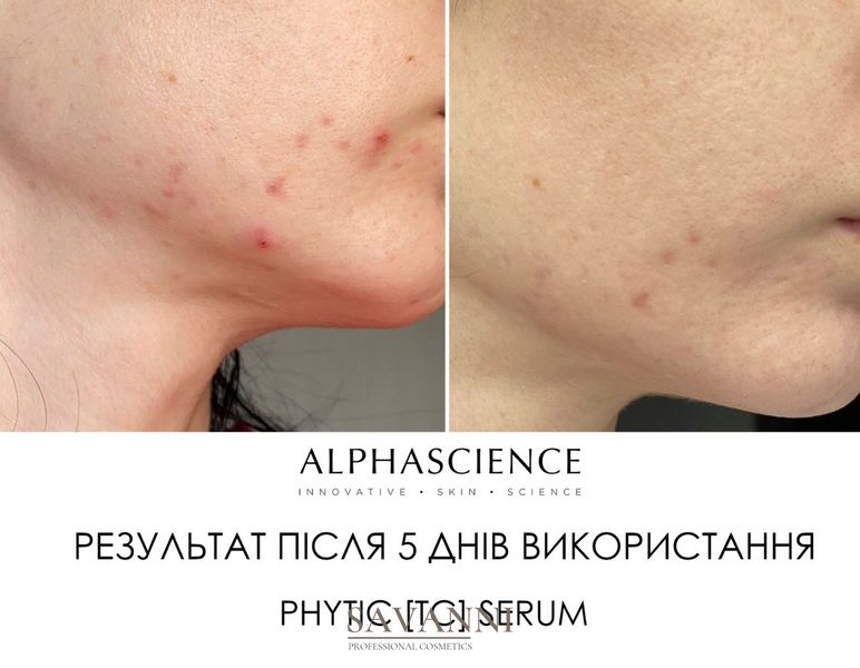 Сироватка фітинова Alphascience Phytic (TC) Serum 8 мл Alph10018 фото 3 savanni.com.ua