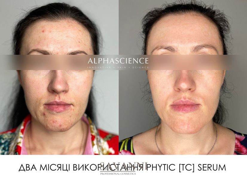 Сироватка фітинова Alphascience Phytic (TC) Serum 8 мл Alph10018 фото 2 savanni.com.ua