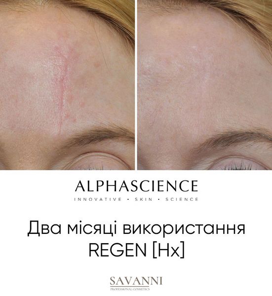 Мощный регенерирующий репарант Alphascience Regen (Hx) 30 мл Alph10020 фото 2 savanni.com.ua