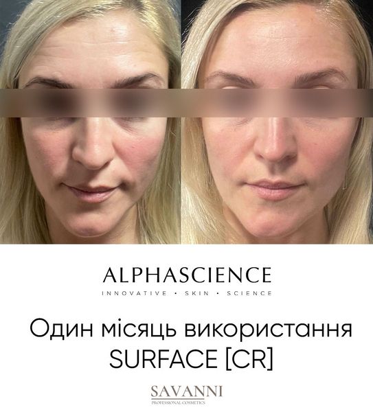 Крем-эмульсия - ультраразглаживающий корректор морщин Surface (CR) Alphascience, 30 мл Alph10021 фото 2 savanni.com.ua