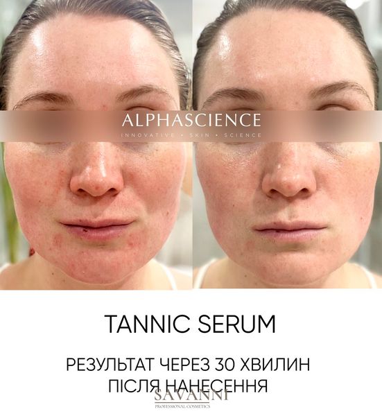 Антиоксидантна сироватка Alphascience Tannic (CF) Serum 8 мл Alph10022 фото 2 savanni.com.ua