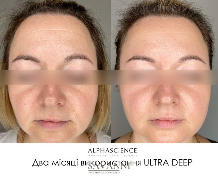 Антивозрастной крем для лица Alphascience Ultra Deep 50 мл Alph10024 фото 3 savanni.com.ua