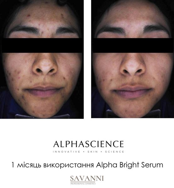 Сироватка проти пігментних плям Alphascience Alpha Bright Serum 20мл Alph10013 фото 5 savanni.com.ua