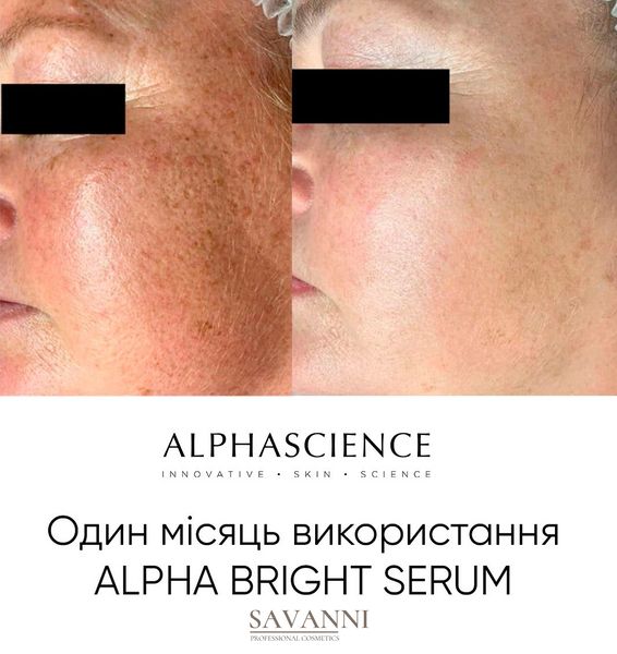 Сыворотка против пигментных пятен Alphascience Alpha Bright Serum 20мл Alph10013 фото 4 savanni.com.ua