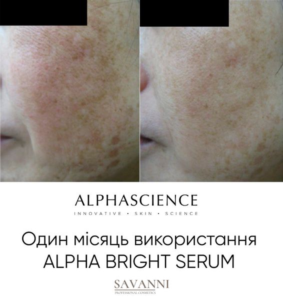 Сыворотка против пигментных пятен Alphascience Alpha Bright Serum 20мл Alph10013 фото 3 savanni.com.ua