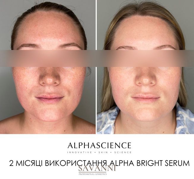 Сироватка проти пігментних плям Alphascience Alpha Bright Serum 20мл Alph10013 фото 2 savanni.com.ua