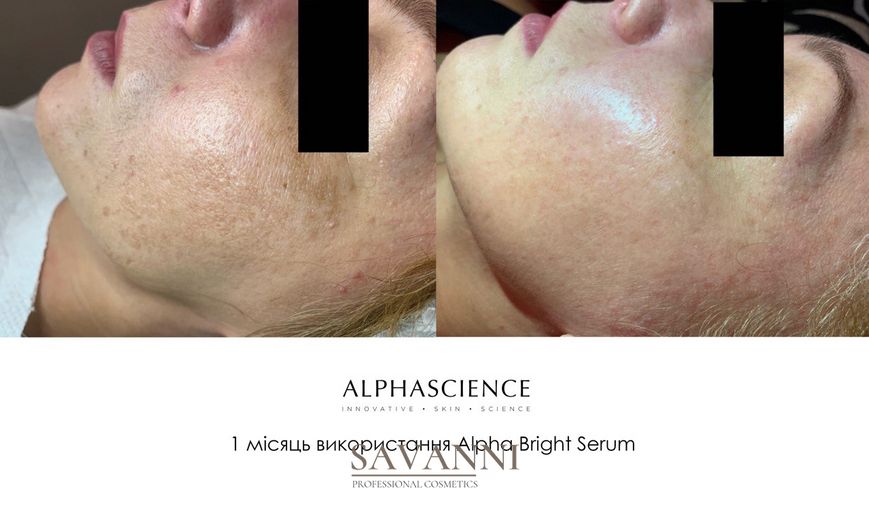 Сыворотка против пигментных пятен Alphascience Alpha Bright Serum 20мл Alph10013 фото 6 savanni.com.ua